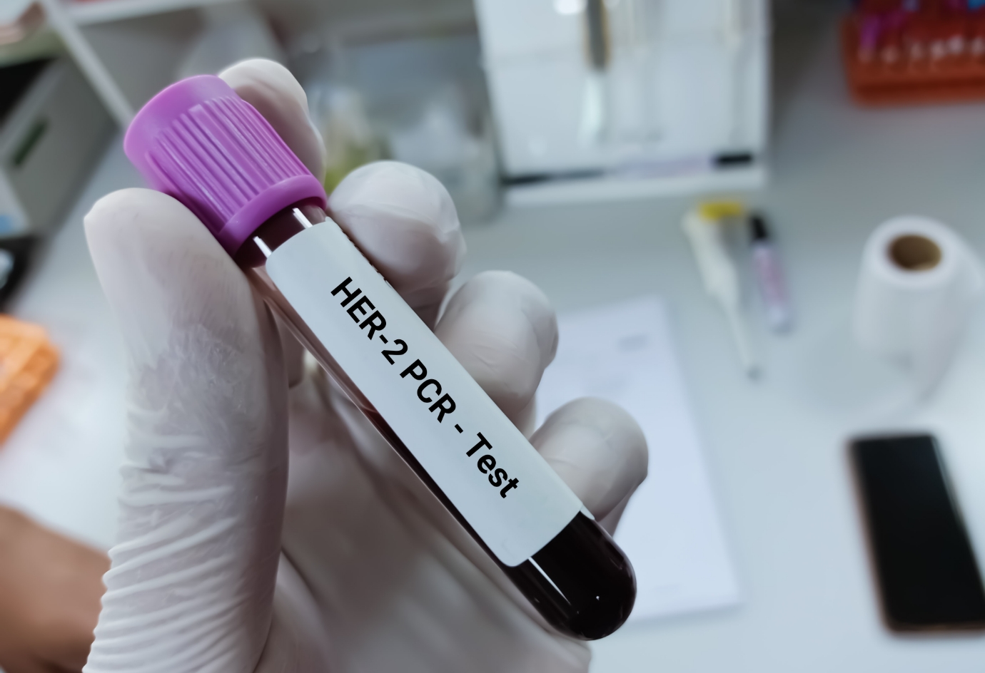 Neue Therapien beim HER2-positiven, metastasierten Brustkrebs