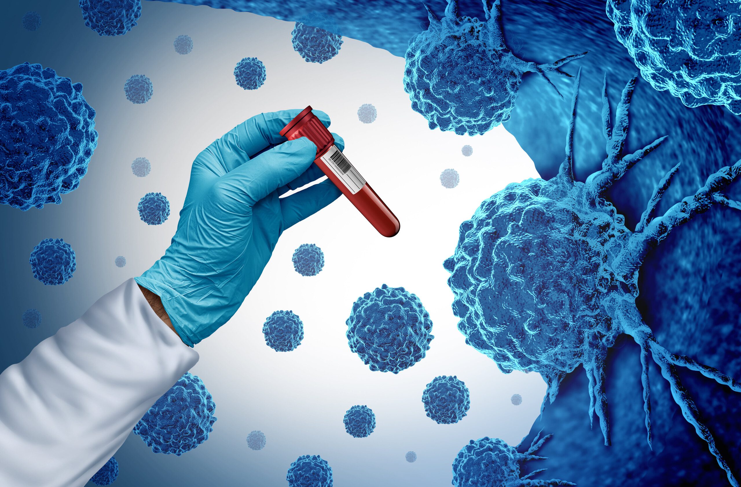 Liquid Biopsy (Flüssigbiopsie)