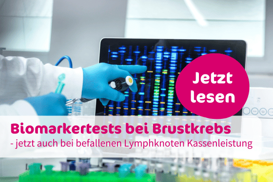 Biomarkertests bei Brustkrebs