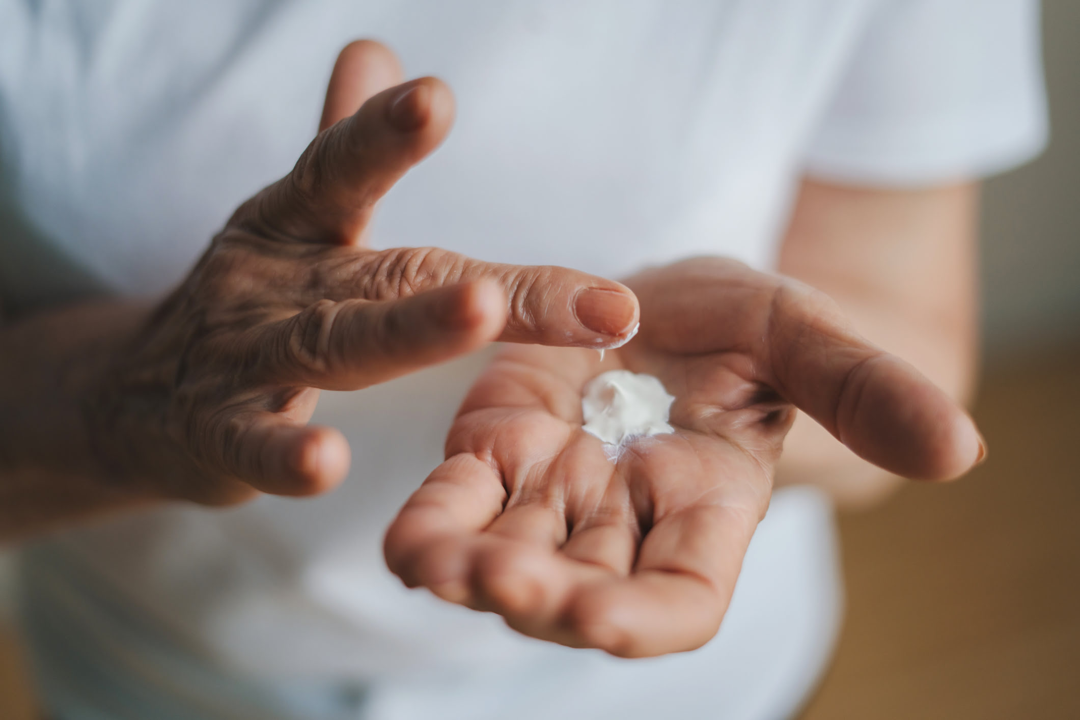Hautpflege während der Strahlentherapie